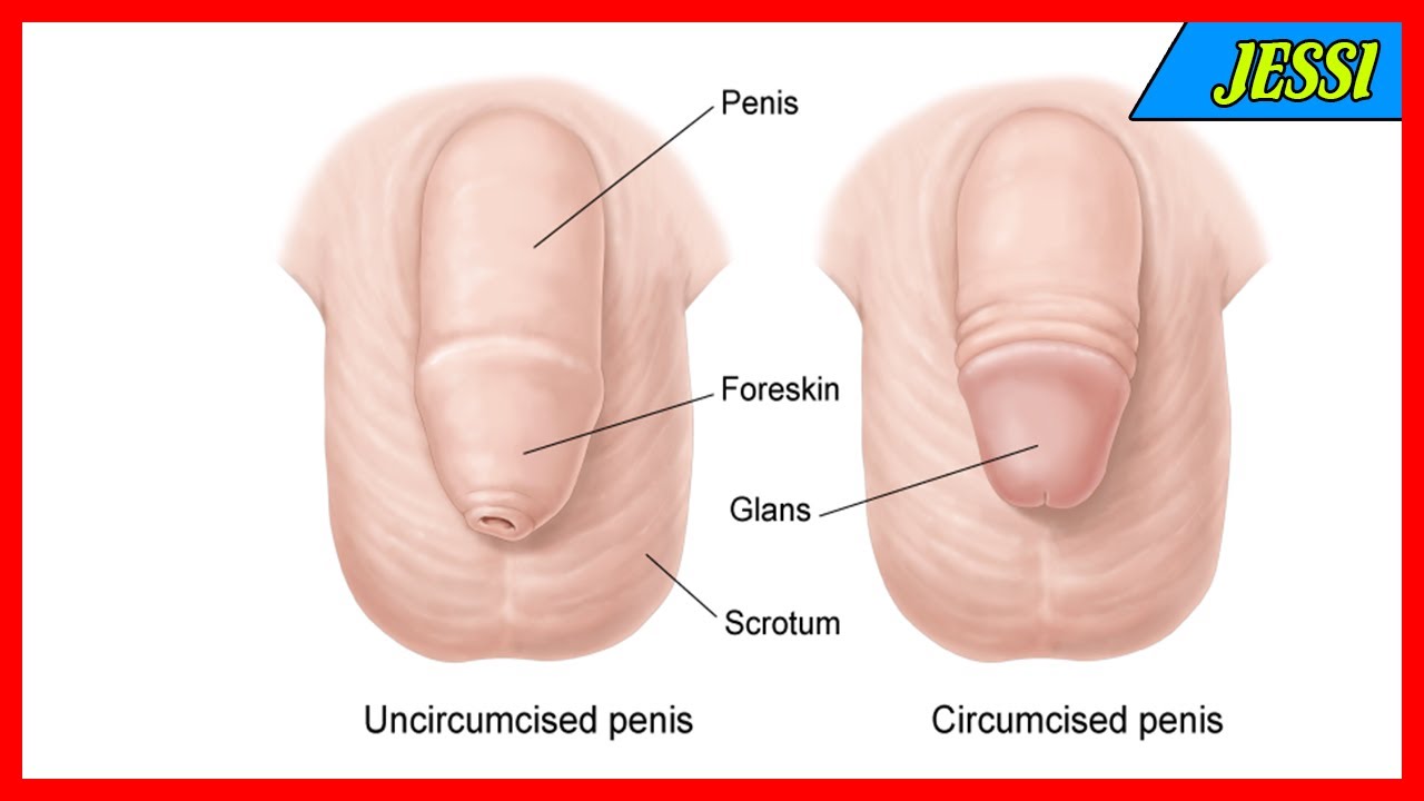 circumcised penises and uncircumcised