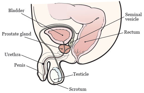 sexual cancer prostate removal