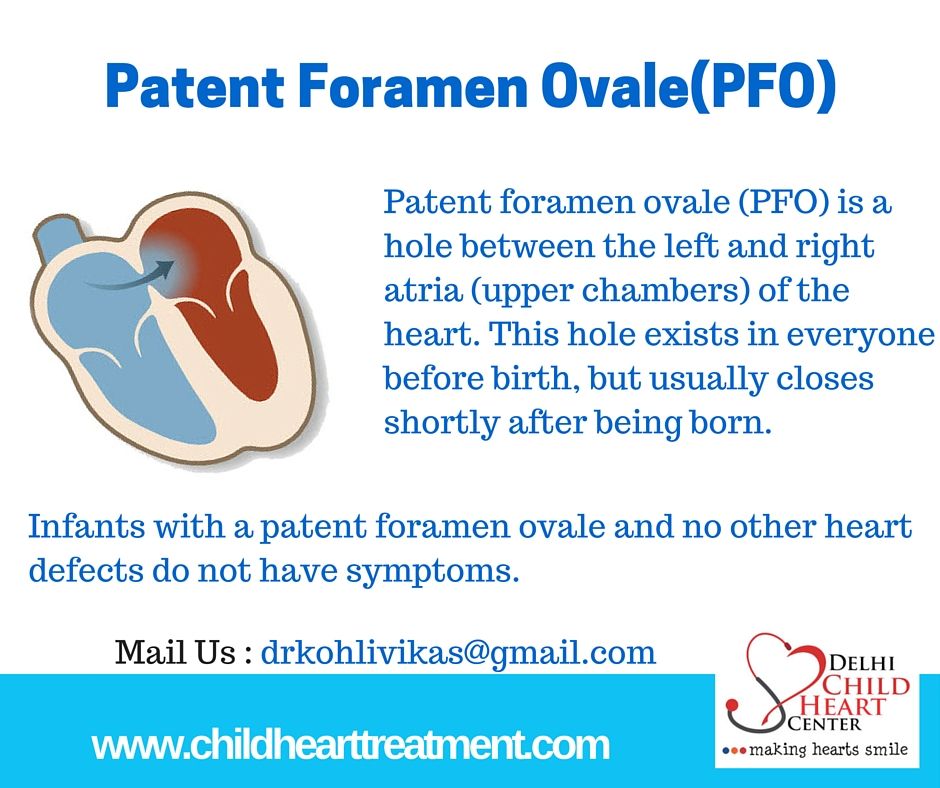 symptoms in patent adults foramen ovale