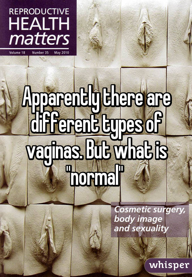 of different vaginas types pics the