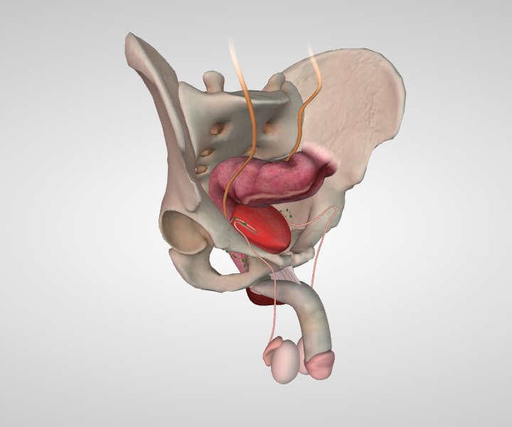 activity prostate sexual surgery
