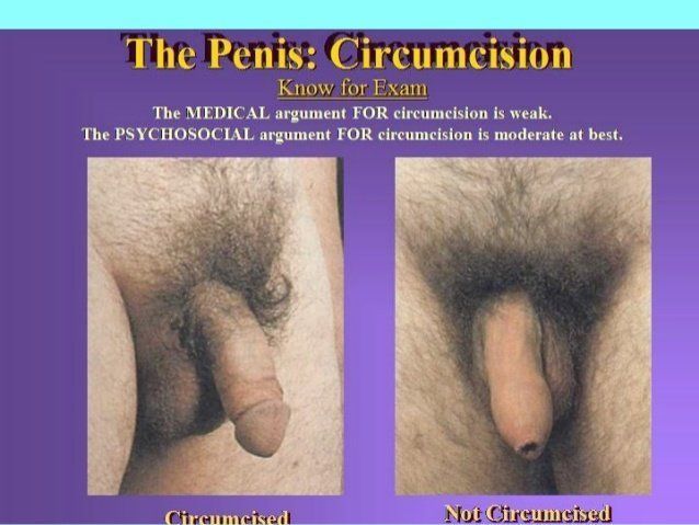 adults of penis uncircumcised