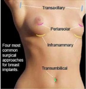 surgery cost breast