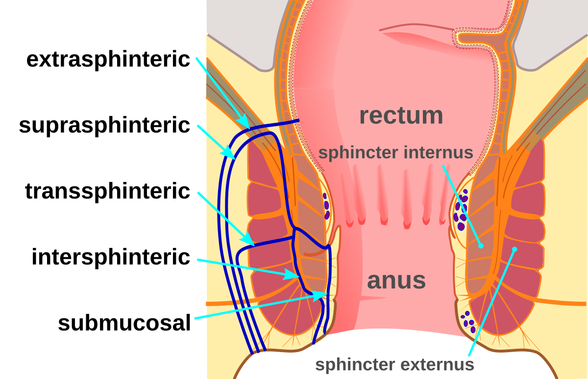 rectum or pain anus