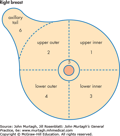 the breast outer Upper right quadrant of